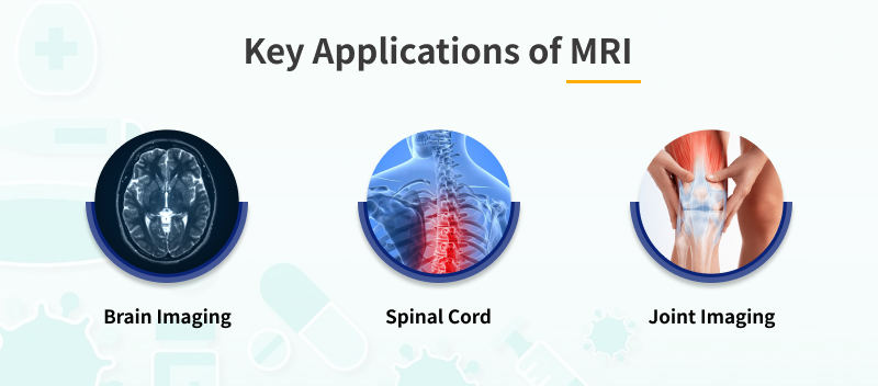 Key Applications of MRI 