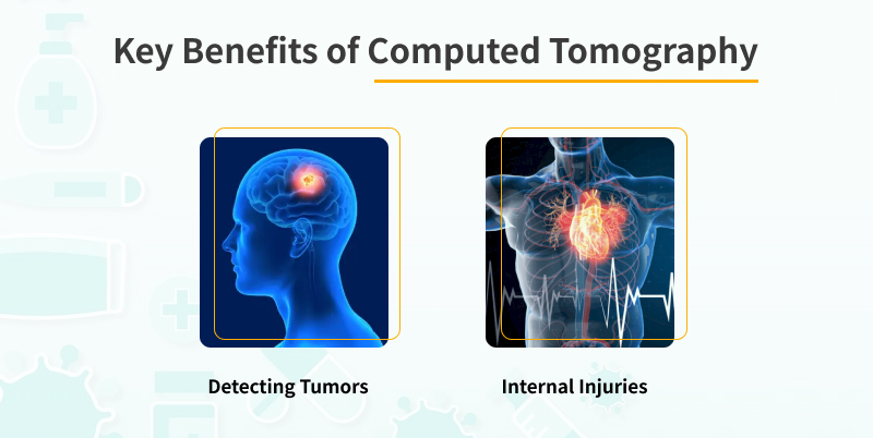 Key Benefits of Computed Tomography