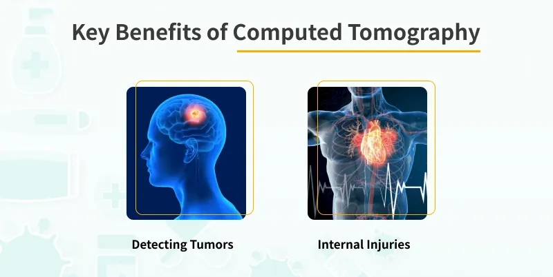 Key Benefits of Computed Tomography